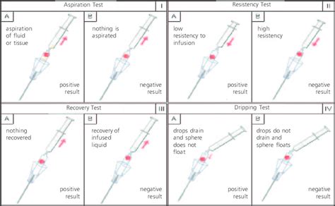 verse needle drop test|veress needle positioning diagram.